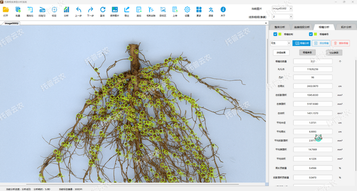 1757053188378415.png 花生-根瘤分析.png